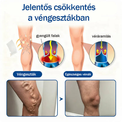 ✨🌿Medistart® Visszérápoló Mikrotűs Gondozó Tapasz ⚡ Azonnali Megkönnyebbülés, Hosszú Távú Eredmények