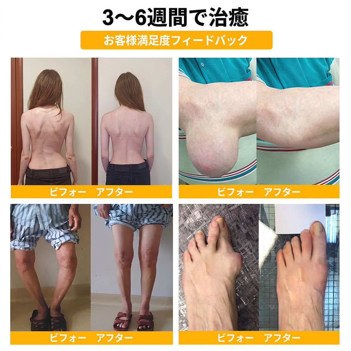 JP DR.HONOR® オールインワン 関節＆骨サポートクリーム🎉🎉 （中高年の方のために特別設計）
