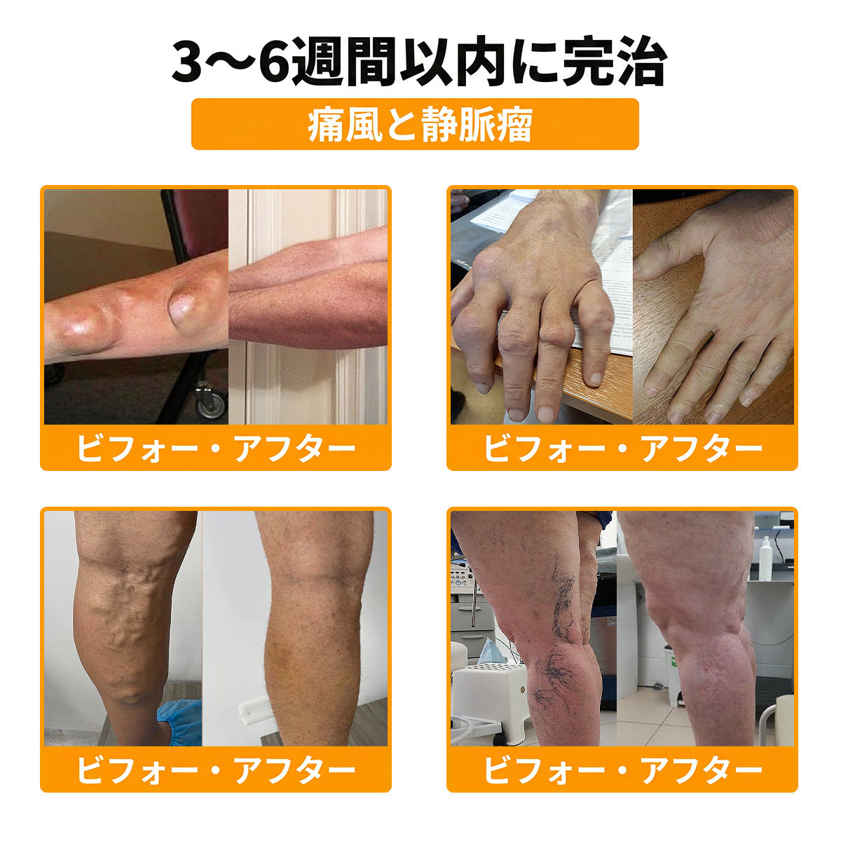 JP DR.HONOR® オールインワン 関節＆骨サポートクリーム🎉🎉 （中高年の方のために特別設計）