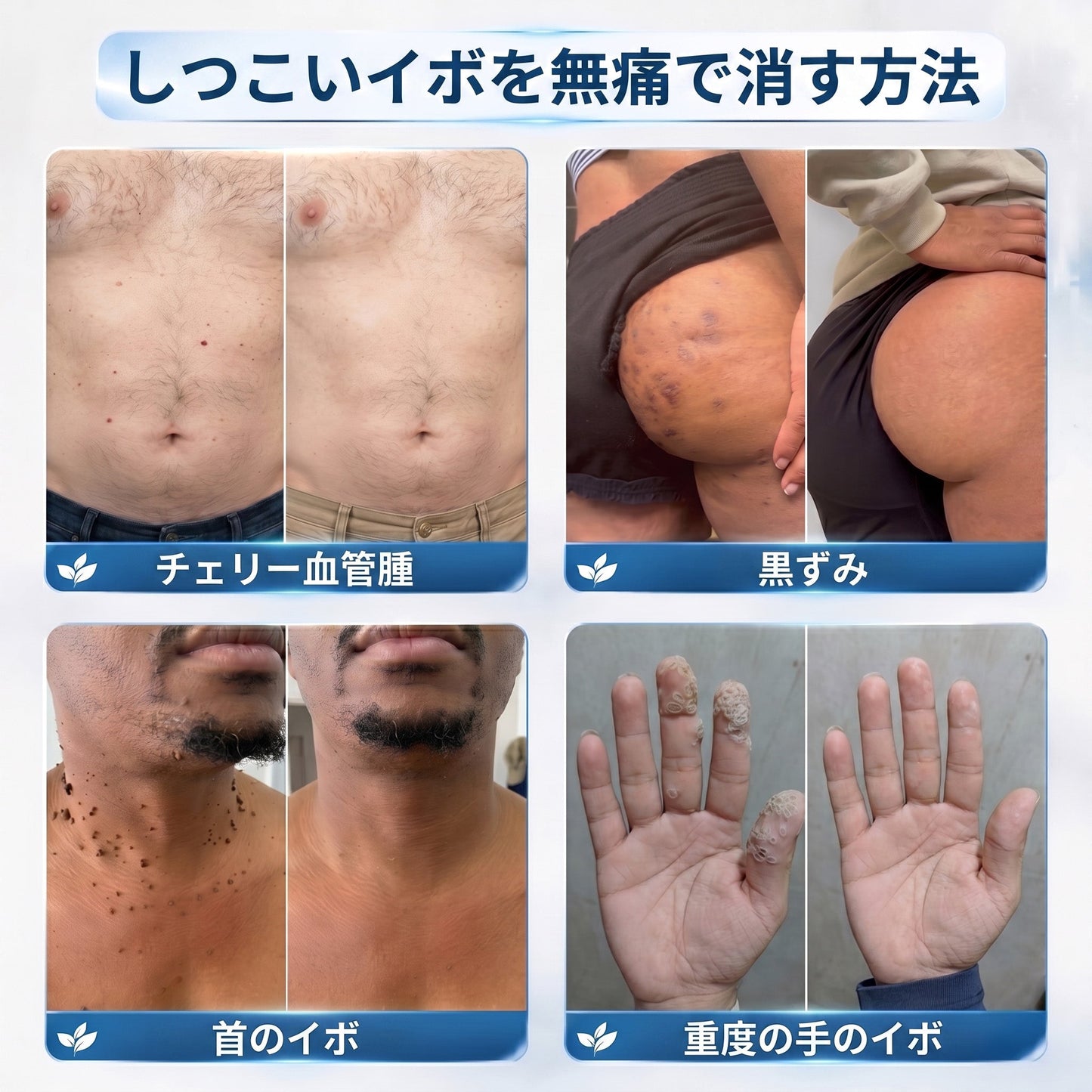 🎁🎁公式ストア𝐇𝐈𝐒𝐊𝐈𝐍®👩‍⚕️ 𝟕日間スキンタグ＆スポットイレーサー（ゼロ痛み・ゼロダメージ ローラーボール）