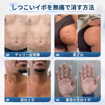 🎁🎁公式ストア𝐇𝐈𝐒𝐊𝐈𝐍®👩‍⚕️ 𝟕日間スキンタグ＆スポットイレーサー（ゼロ痛み・ゼロダメージ ローラーボール）